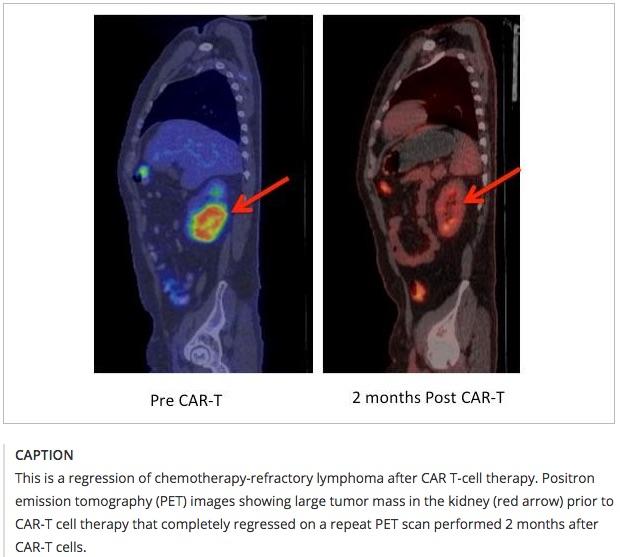 cancer scan.jpg