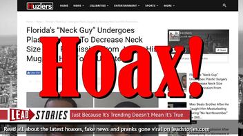 Fake News: Florida's 'Neck Guy' Did NOT Undergo Plastic Surgery To Decrease Neck Size