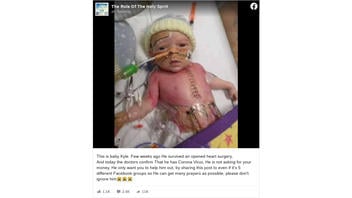 Fact Check: 'Baby Kyle' Did NOT Recently Have Heart Surgery And Does NOT Have COVID-19