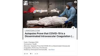 Fact Check: Coronavirus Is NOT Disseminated Intravascular Coagulation; NO Pathophysiological Diagnosis Error