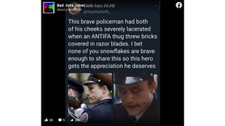 Fact Check: Policeman Did NOT Get Disfigured -- That's Heath Ledger's Joker