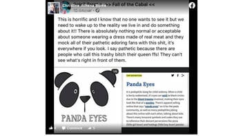 Fact Check: NO Evidence 'Panda Eyes' Bruising Is A Pedophile Phenomenon or Slang Term