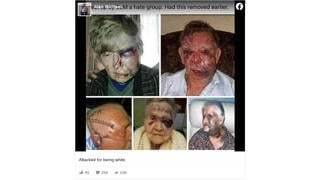 Fact Check: These Photos Do NOT Show Seniors Beaten By BLM