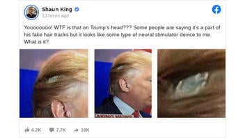 Fact Check: NO Evidence That Photos Show Donald Trump With A 'Neural Stimulator Device'