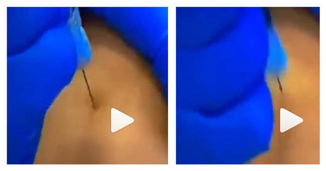 Syringe.jpg