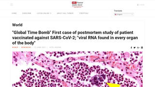 Fact Check: First Postmortem Study In A Patient Vaccinated Against SARS-CoV-2 Did NOT Find Viral RNA In 'Every Organ Of The Body'
