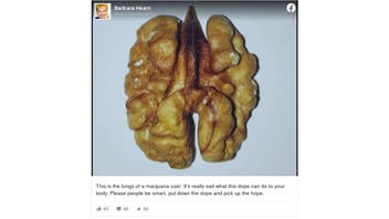 Fact Check: Image Of A Walnut Is NOT The 'Lungs Of A Marijuana User'