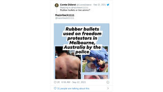 Fact Check: Photos Of People Wounded By Rubber Bullets Are NOT From Melbourne, Australia