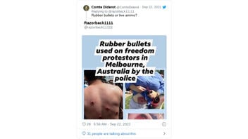 Fact Check: Photos Of People Wounded By Rubber Bullets Are NOT From Melbourne, Australia