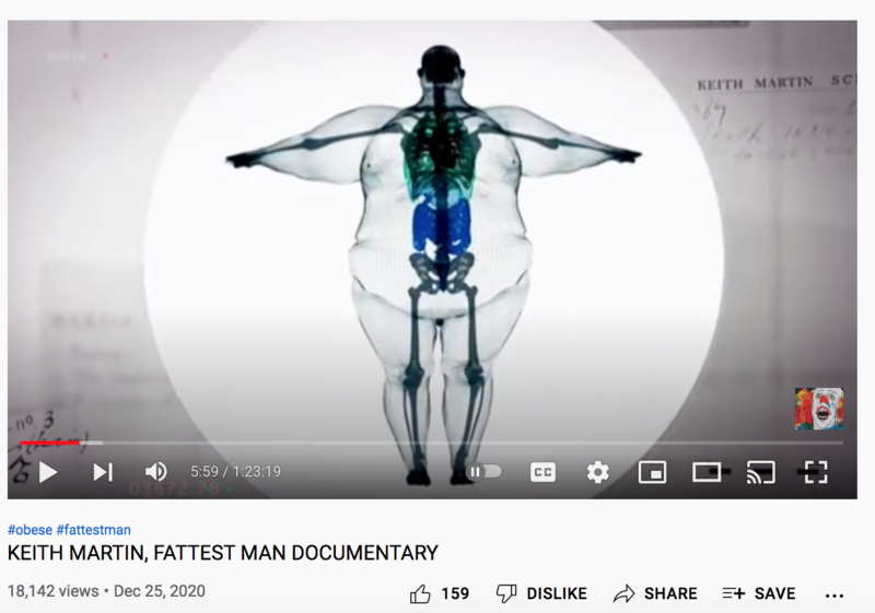 Fact Check: This Is NOT An X-Ray Of A 700-Pound Man -- It's A Digital ...