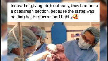 Fact Check: Twins NOT Delivered By C-Section Because They Were Holding Hands -- They Clasped Hands After Delivery
