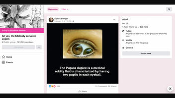 Fact Check: Pupula Duplex Is NOT An Eyeball With Two Pupils -- Clinical Term Is Polycoria
