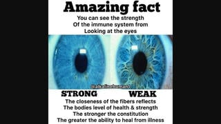 Fact Check: Fibers In Eye Do NOT Indicate Immune System Strength