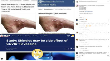 Fact Check: NO Evidence COVID-19 Vaccines Cause Monkeypox, Shingles