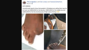Fact Check: People In Zimbabwe Are NOT 'Selling Their Toes' For Thousands -- It's A Joke