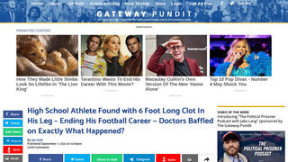 Fact Check: High School Athlete Did NOT Get COVID-19 Vaccine Before 6-Foot-Long Clot In His Leg