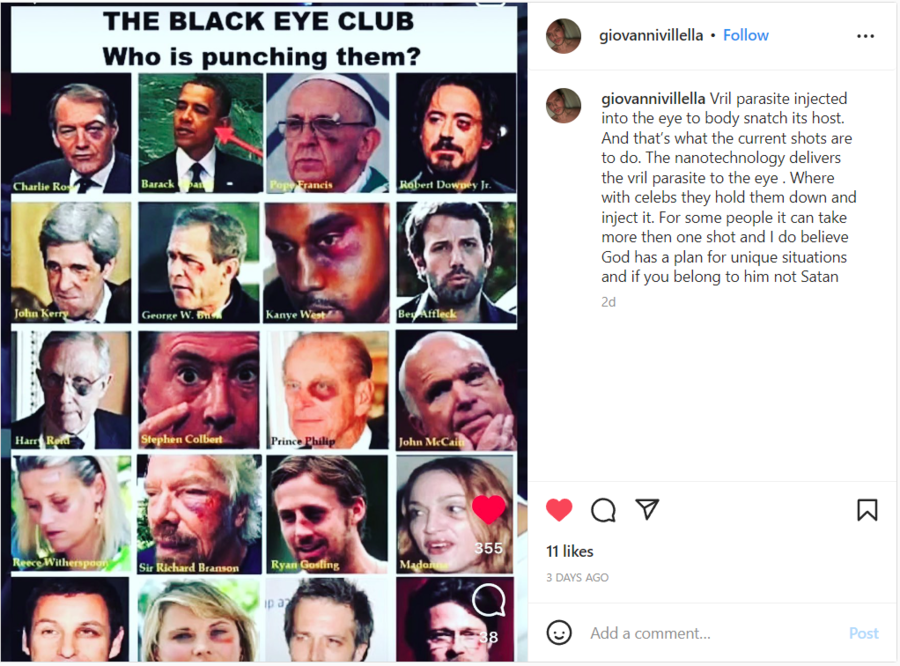 Black Eye Instagram.png