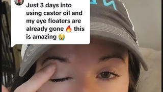 Fact Check: Rubbing Castor Oil On Eyelids Does NOT Remove Eye Floaters In Days  