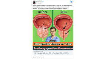 Fact Check: Dr. Oz Did NOT Promote A 'Cure' For Prostate Disease