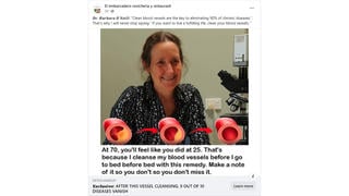 Fact Check: Social Media Post NOT Endorsement Of CBD Gummies For High Blood Pressure By Barbara O'Neill