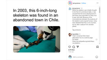 Fact Check: Atacama Skeleton Is NOT An Alien -- It's Human Fetus