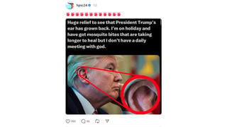 Fact Check: Photo Does NOT Show Undamaged Ear In Immediate Weeks After Trump Shooting