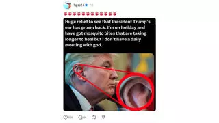 Fact Check: Photo Does NOT Show Undamaged Ear In Immediate Weeks After Trump Shooting