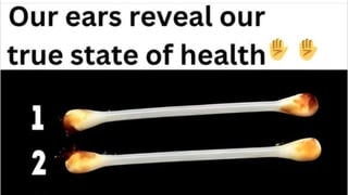 Fact Check: Earwax Color Does NOT Reveal 'True State' Of Your Health