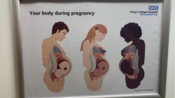 Fact Check: NHS King's College Hospital Does NOT Produce Or Post An Informational Poster That Shows Pregnant Men 