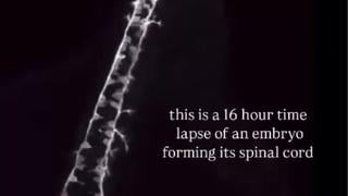 Fact Check: Timelapse Shows Zebrafish Nervous System Developing In Sixteen Hours -- Not Human Embryo Spinal Cord