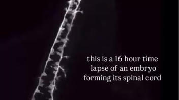 Fact Check: Timelapse Shows Zebrafish Nervous System Developing In Sixteen Hours -- Not Human Embryo Spinal Cord