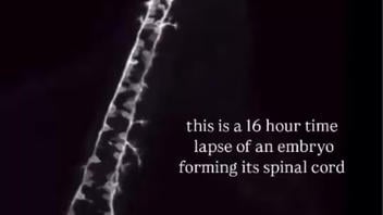 Fact Check: Timelapse Shows Zebrafish Nervous System Developing In Sixteen Hours -- Not Human Embryo Spinal Cord