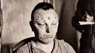 Fact Check: Fake AI Image Does NOT Prove 'James Peterson' Was Lobotomized For Being Gay In 1948