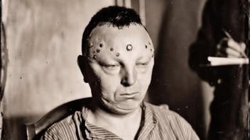 Fact Check: Fake AI Image Does NOT Prove 'James Peterson' Was Lobotomized For Being Gay In 1948