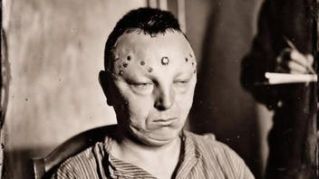 Fact Check: Fake AI Image Does NOT Prove 'James Peterson' Was Lobotomized For Being Gay In 1948
