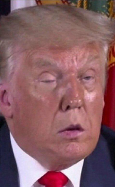 Trump droopy eyed.jpg