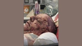 Fact Check: Photo Of Wounded Face Is NOT Of Belfast Attack Victim Steven Ogilvie -- Police Confirm