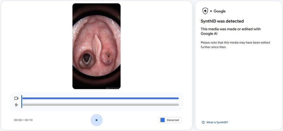 throatSynthID.jpg