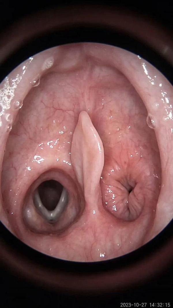 throatthumbnail.jpg