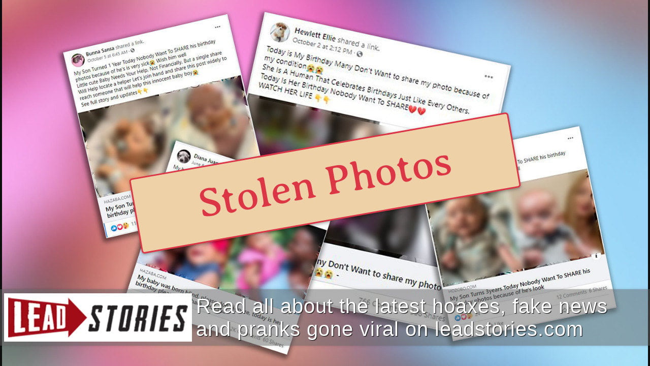 Fact Check: The Cute Baby With A Medical Condition Is Being Used By An ...