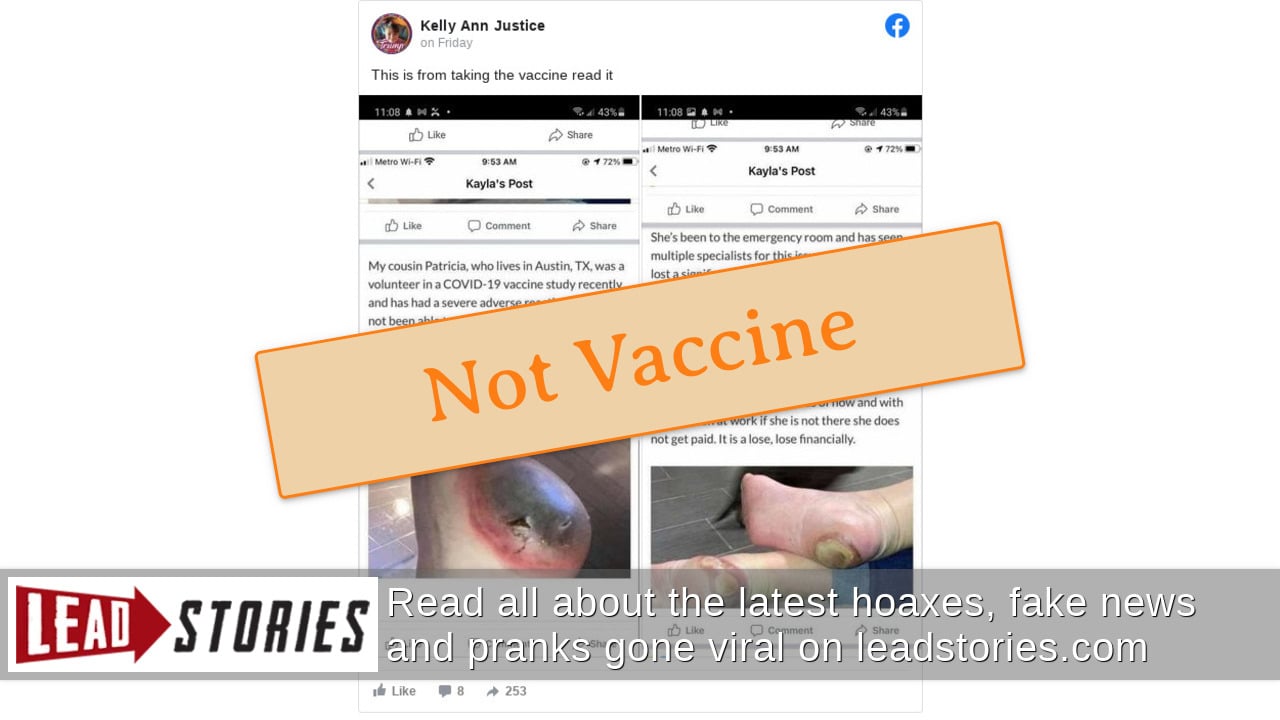 Fact Check: Women with foot pain were not on trial with the COVID-19 vaccine