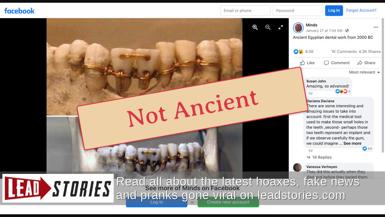 Fact Check This Photo Is NOT Ancient Egyptian Dentistry This Dental