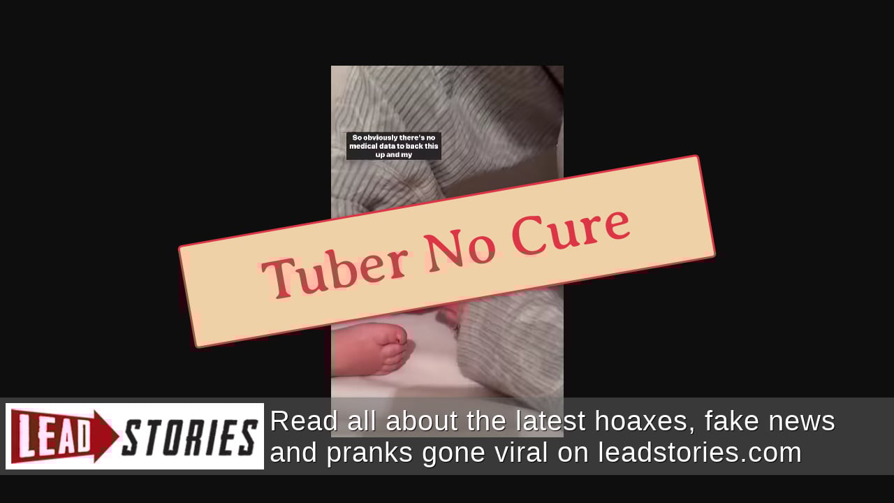 Fact Check Cut Potato In Sock Does NOT Combat Cold And Flu Lead Stories