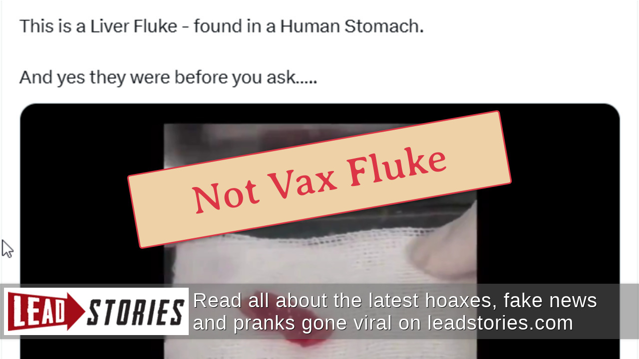 Fact Check: Vaccines Do NOT Cause Liver Flukes; Parasites Come From ...